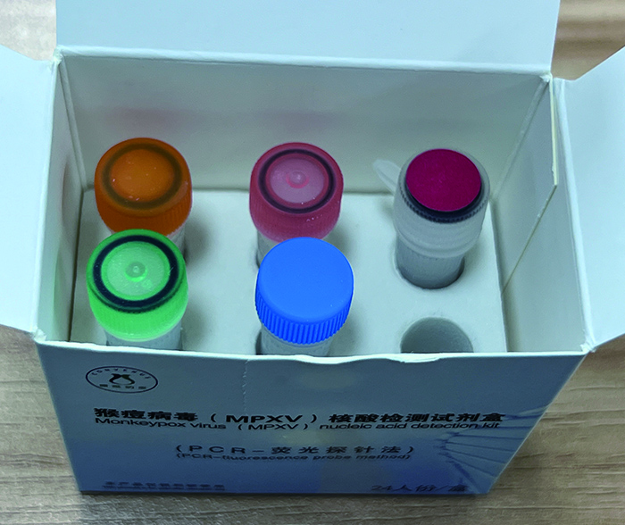 Monkeypox Virus DNA Realtime Fluorescence（Qualitative (Probe) PCR Kit ）